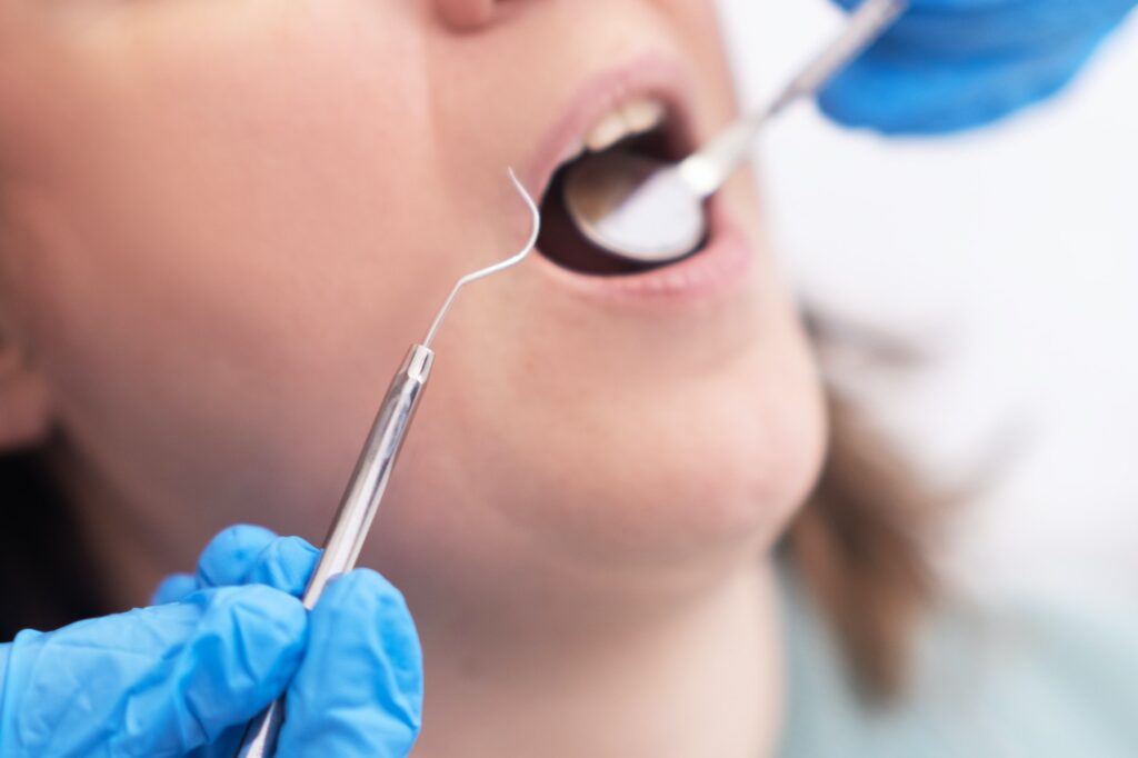 dental treatment to maintain her oral health by dental specialist dental facility. close up: Can I Get a Tooth Pulled While Pregnant? Surprising Facts